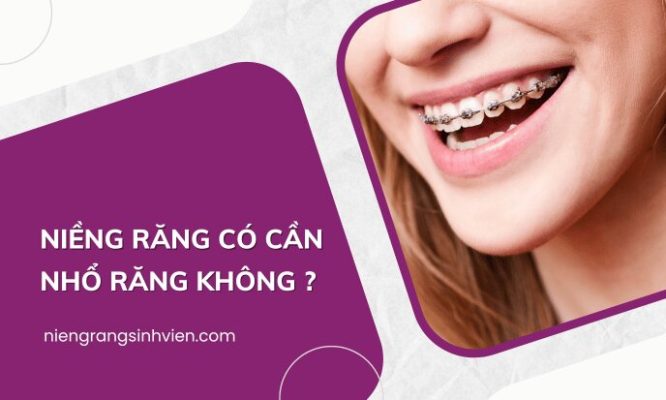 Niềng răng có cần nhổ răng không ?