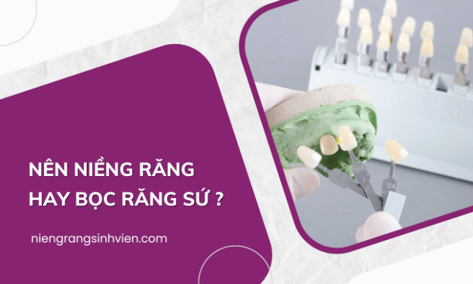 Nên niềng răng hay bọc răng sứ ?