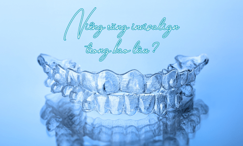 Thời gian niềng răng trong suốt invisalign mất bao lâu ?