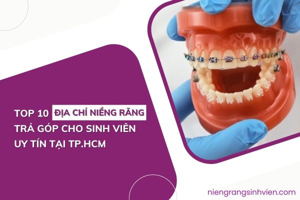 Top 10 địa chỉ niềng răng trả góp cho sinh viên uy tín tại Tp.HCM