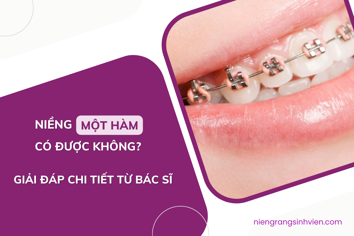 niềng răng 1 hàm có được không