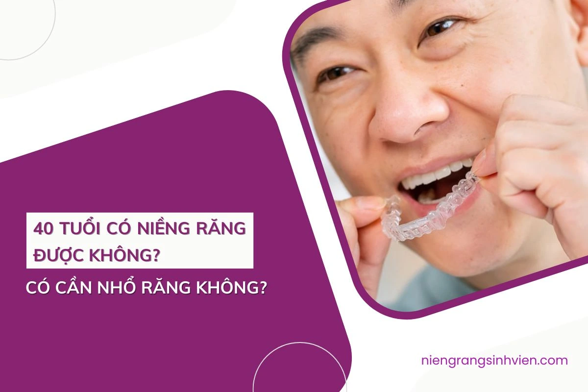 40 tuổi có niềng răng được không