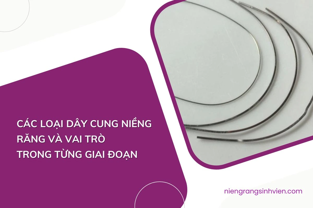 các loại dây cung niềng răng