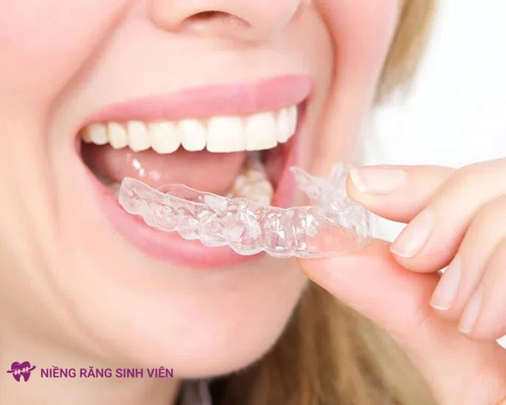 các loại niềng răng trong suốt