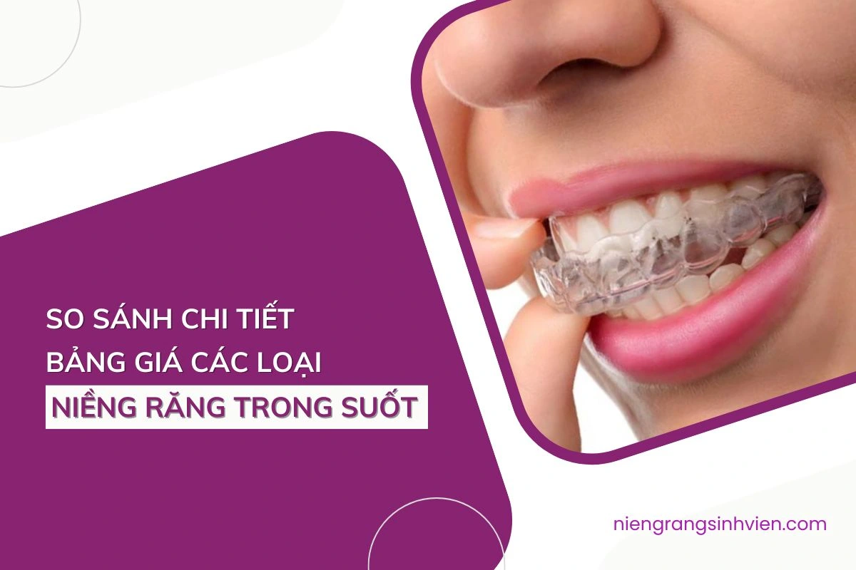 các loại niềng răng trong suốt
