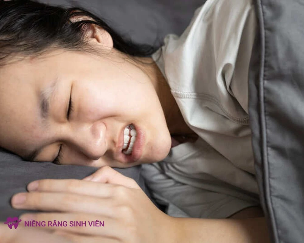nâng khớp cắn trong niềng răng