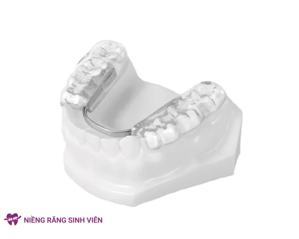 nâng khớp cắn trong niềng răng
