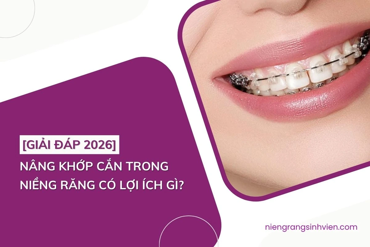 nâng khớp cắn trong niềng răng