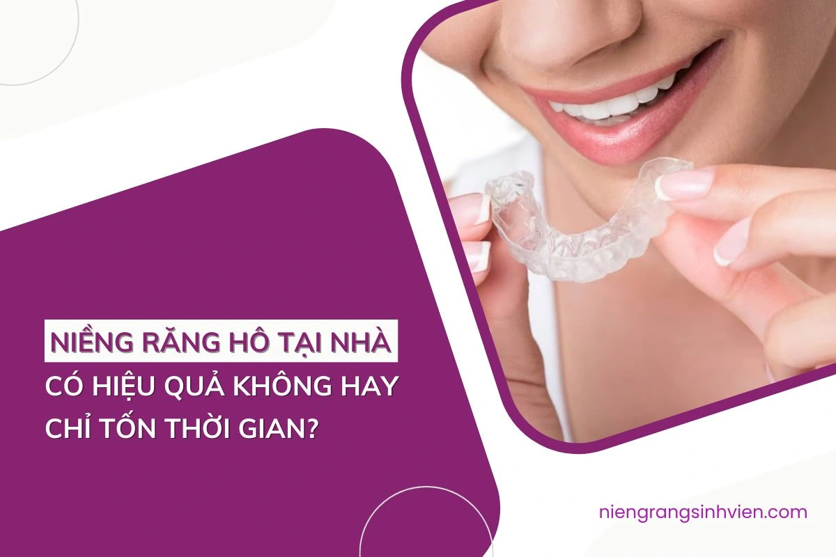 niềng răng hô tại nhà