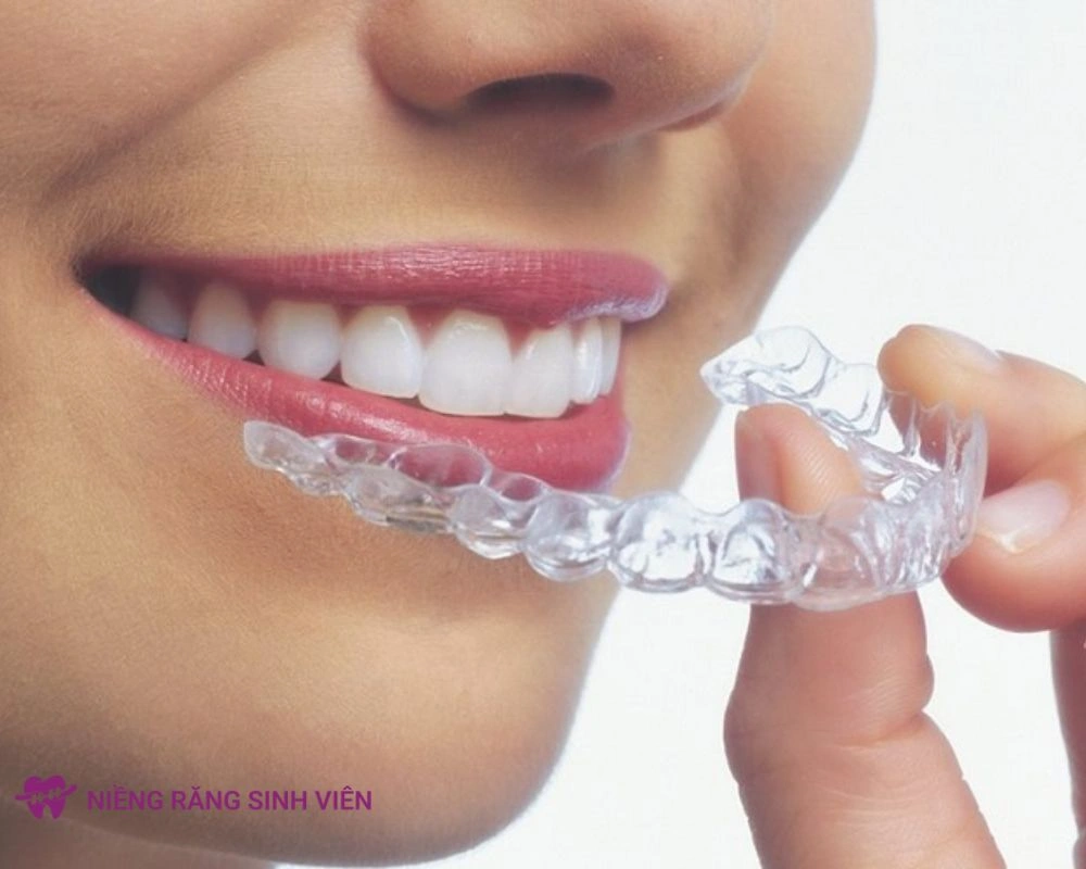 niềng răng trong suốt có đau không