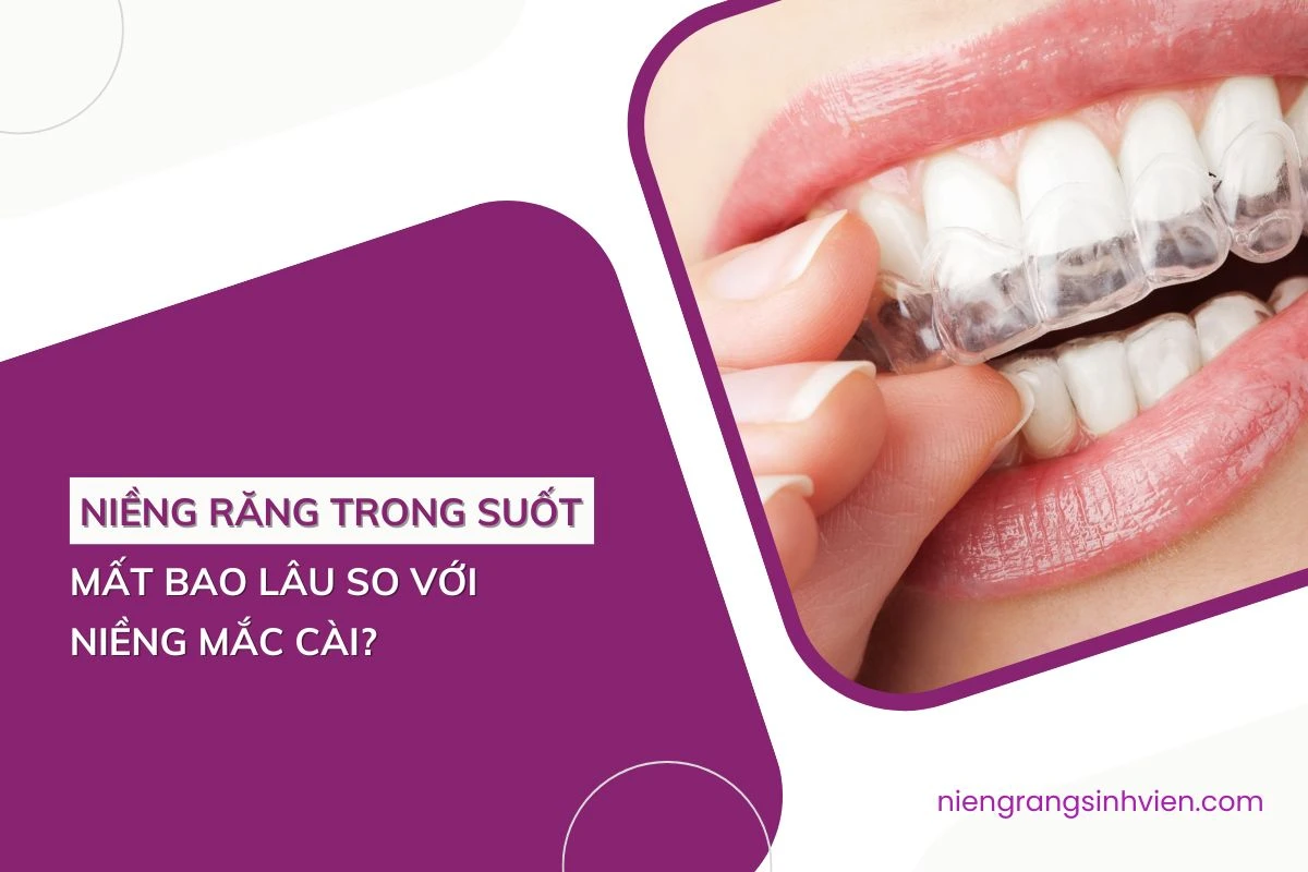 niềng răng trong suốt mất bao lâu