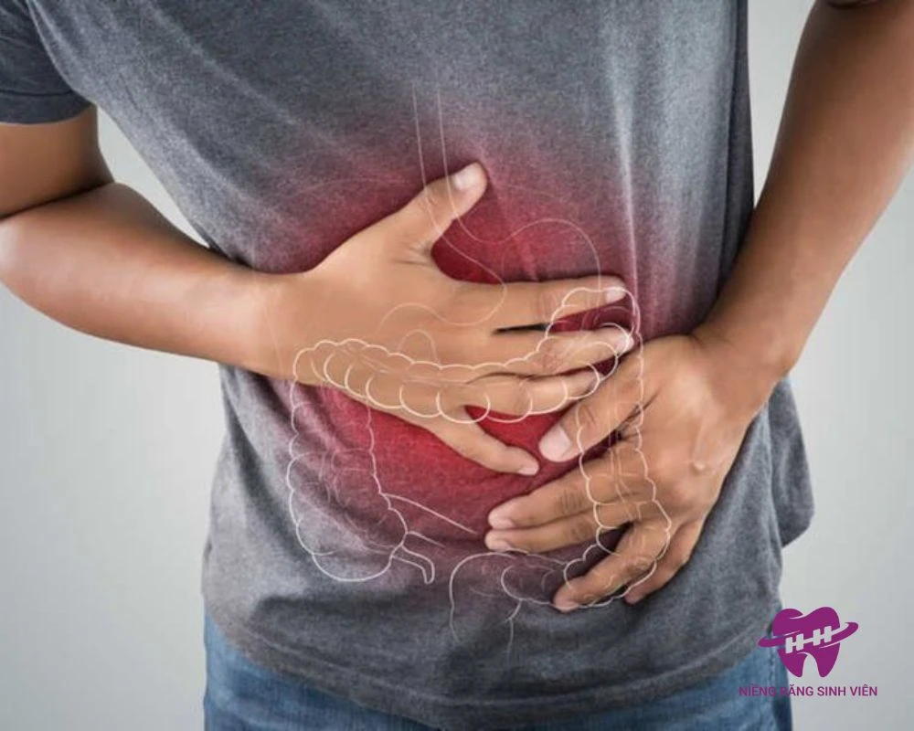 nuốt mắc cài niềng răng có sao không