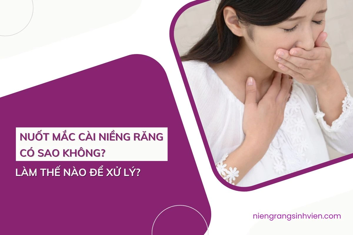 nuốt mắc cài niềng răng có sao không