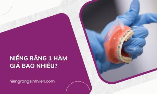 Niềng răng 1 hàm giá bao nhiêu? Có nên niềng không ?