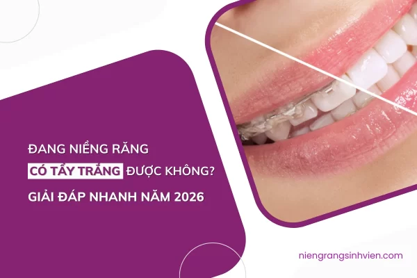 niềng răng có tẩy trắng được không