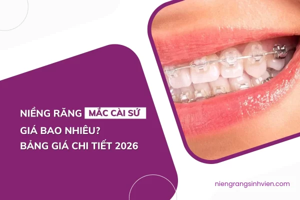bảng giá niềng răng mắc cài sứ