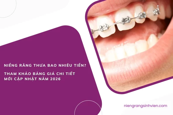 niềng răng thưa bao nhiêu tiền