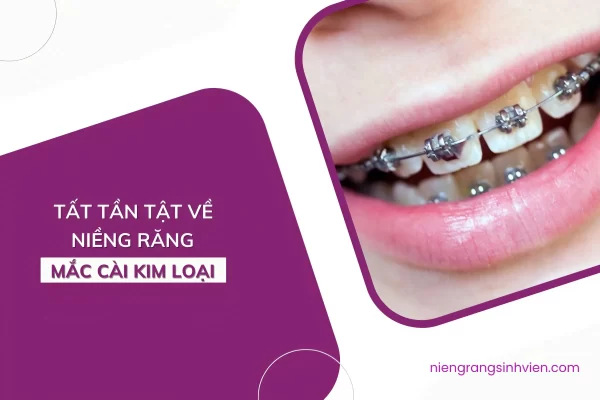 nieng rang mac cai kim loai