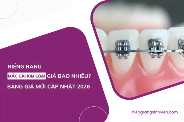 niềng răng mắc cài kim loại thường giá bao nhiêu
