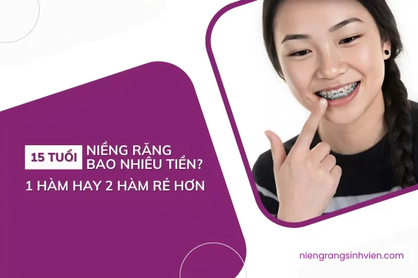 15 tuổi niềng răng bao nhiêu tiền