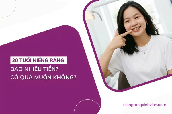 20 tuổi niềng răng bao nhiêu tiền