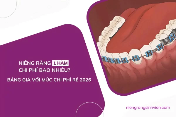 niềng răng bao nhiêu tiền 1 hàm