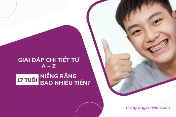 17 tuổi niềng răng bao nhiêu tiền