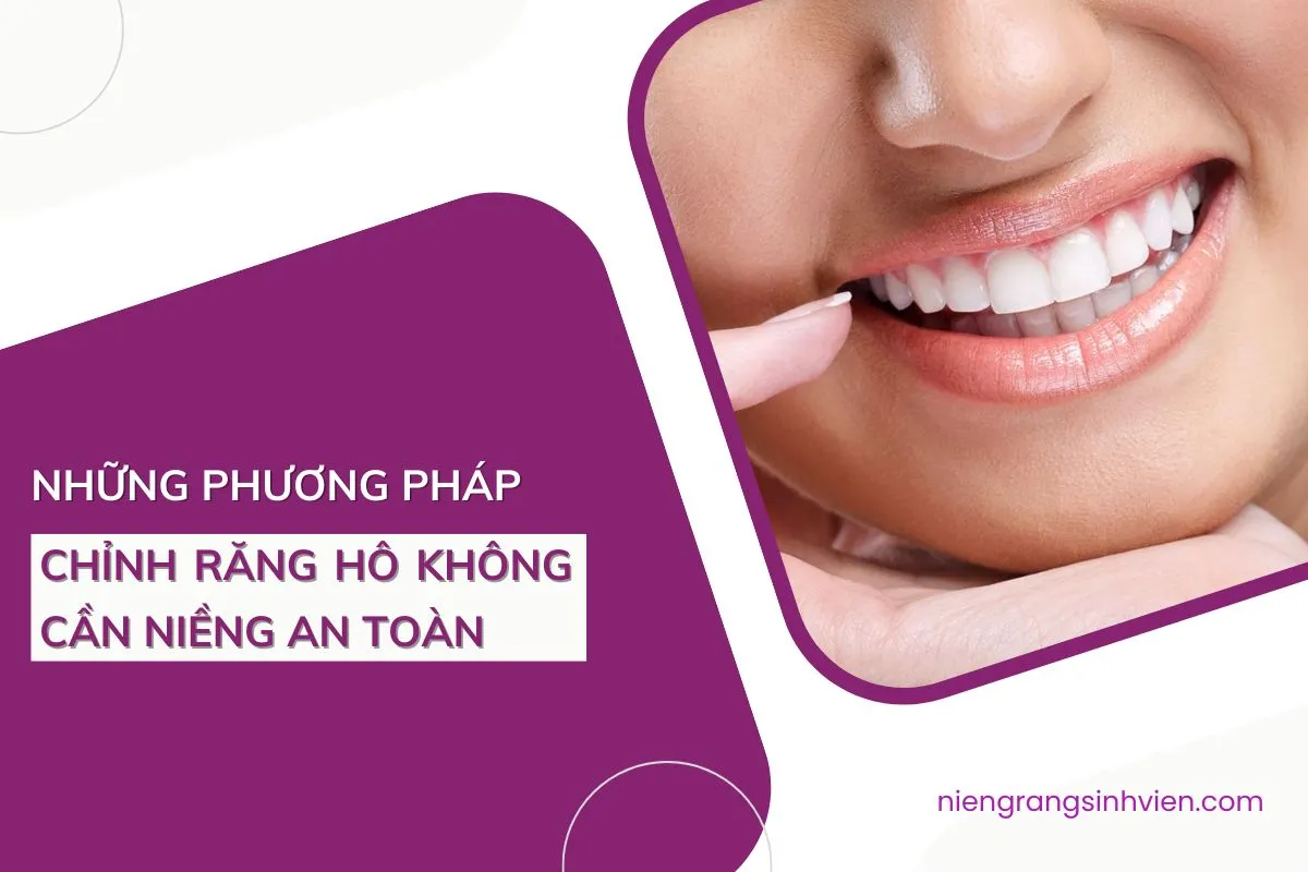 chỉnh răng hô không cần niềng