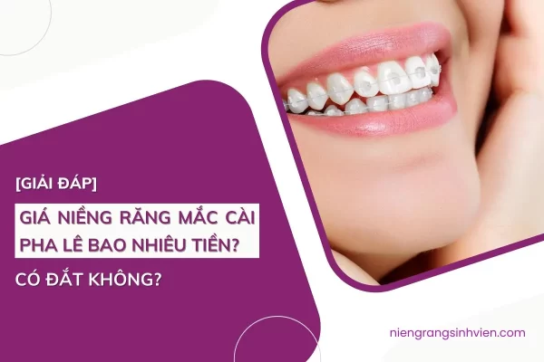 giá niềng răng mắc cài pha lê