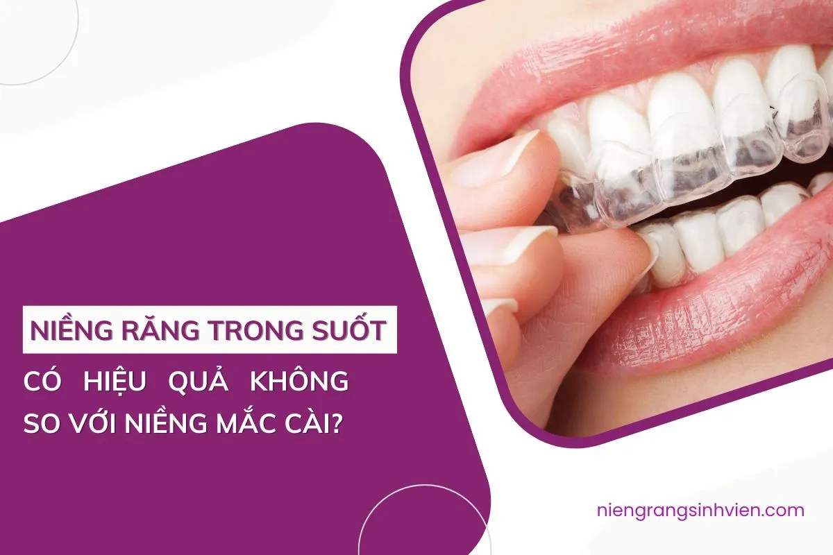 niềng răng trong suốt có hiệu quả không