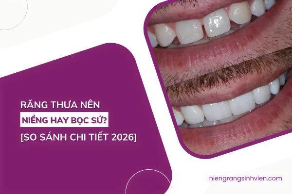 răng thưa nên niềng hay bọc sứ