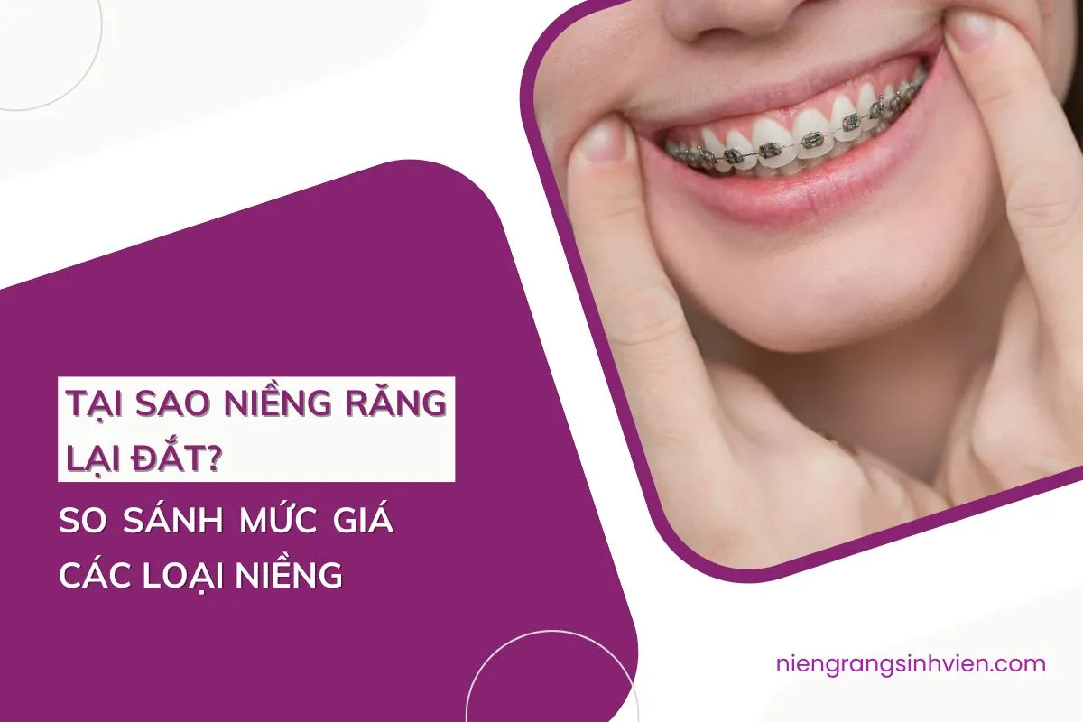 tại sao niềng răng lại đắt