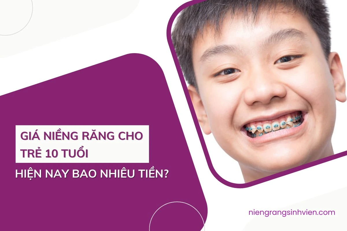 giá niềng răng cho trẻ 10 tuổi