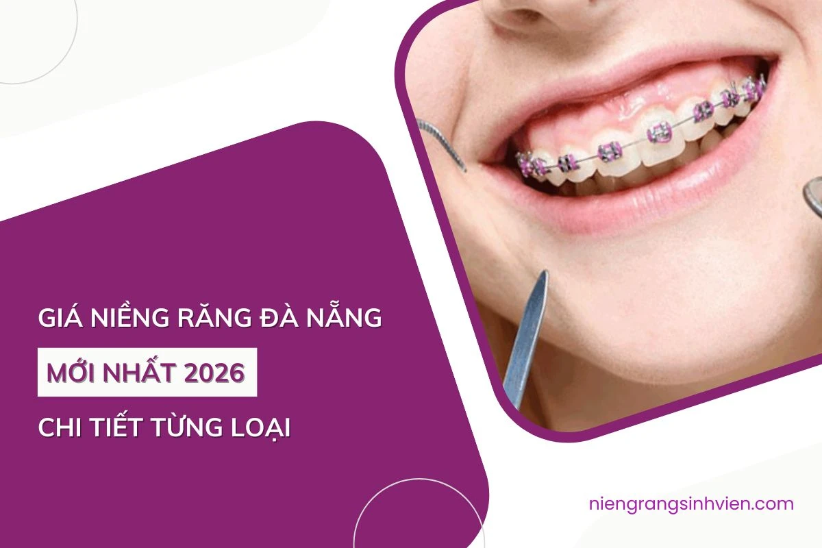 giá niềng răng đà nẵng