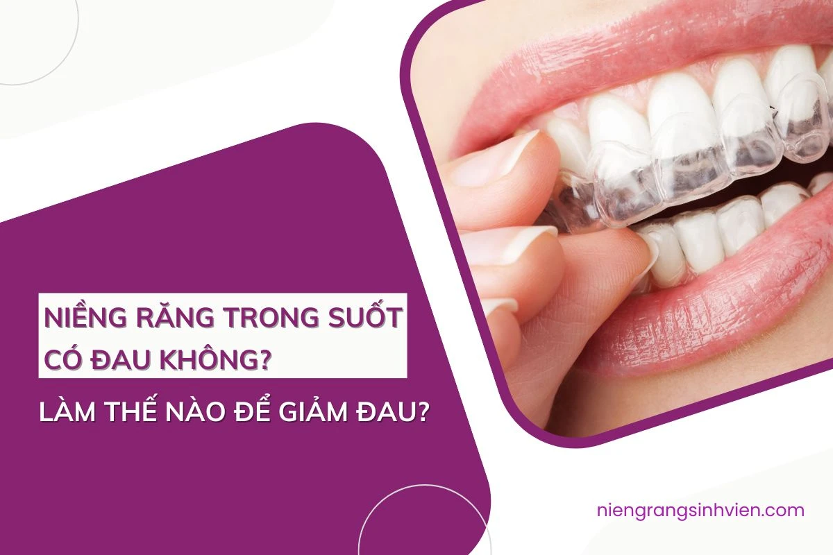 niềng răng trong suốt có đau không