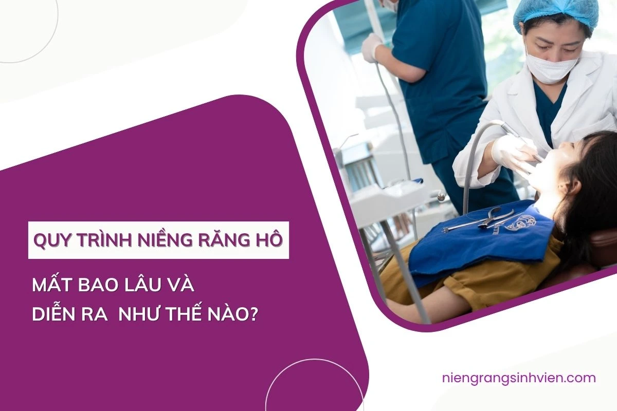quy trình niềng răng hô