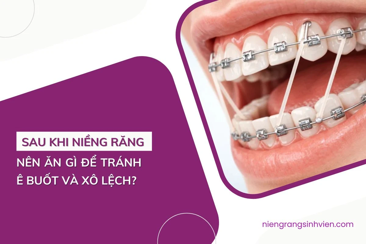 sau khi niềng răng nên ăn gì
